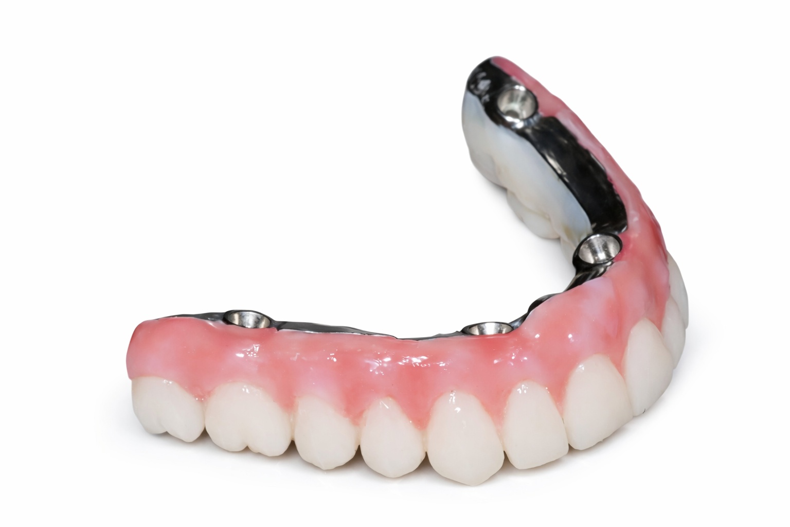 Tratamiento All-on-4 en Valencia con dientes fijos sobre 4 implantes