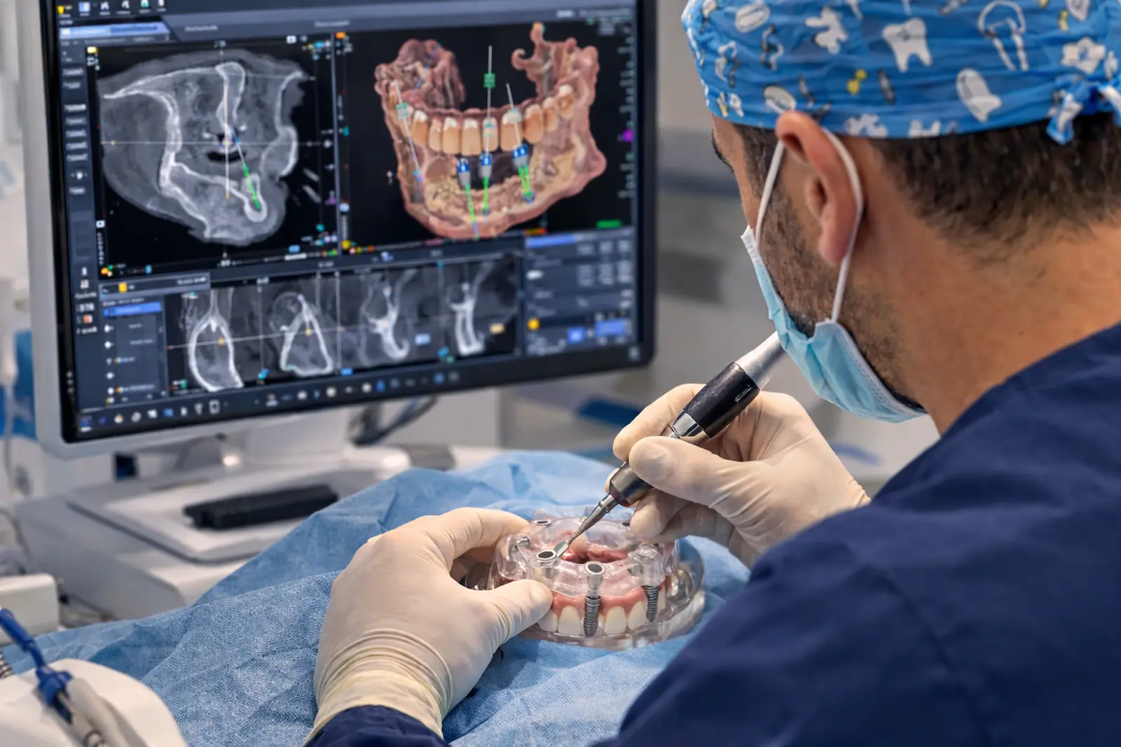 Cirugía guiada para implantes dentales con férula quirúrgica en Valencia