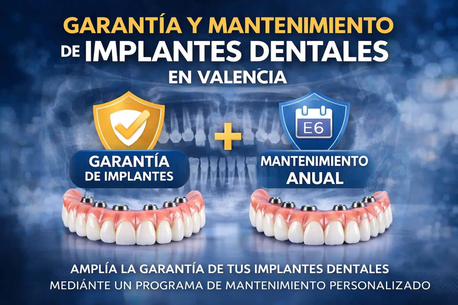 garantia y mantenimiento de implantes dentales en Valencia con radiografia panoramica mostrando implantes