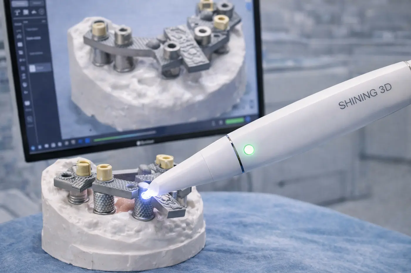 Escaneo digital de implantes con Scan Ladder para prótesis fija sobre implantes en Valencia